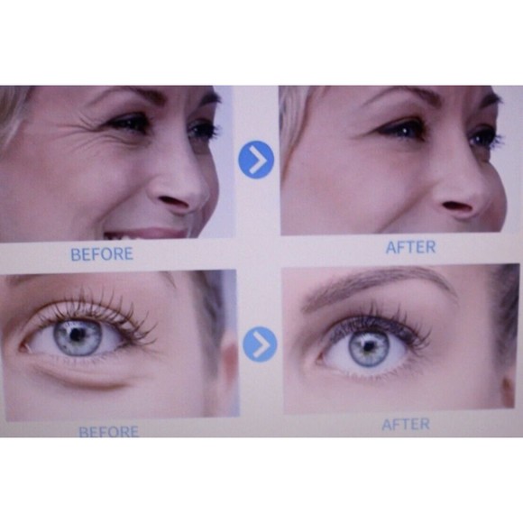 Retinol Serum for Skin Care Oil Drops Improve Elasticity .68 Fl.Oz. NIP - Picture 8 of 8